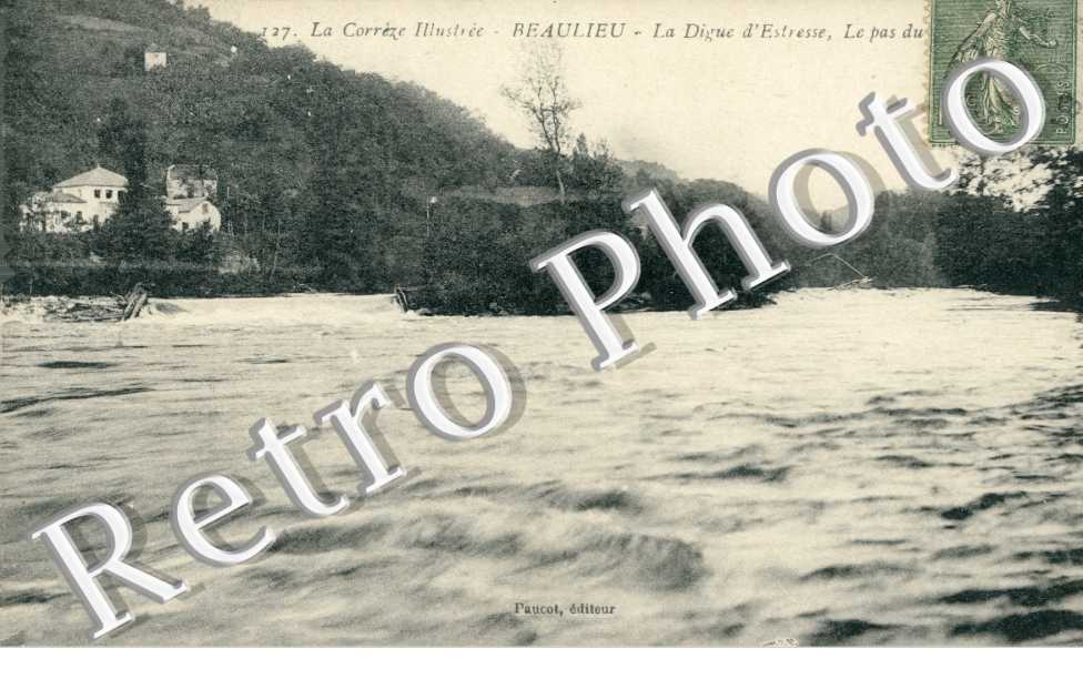 La digie d'Estresse