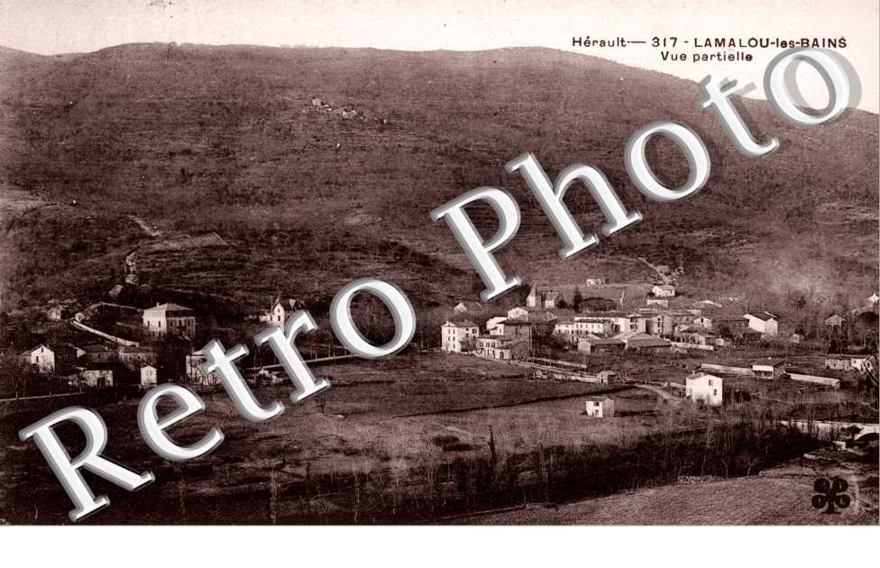 vue partielle