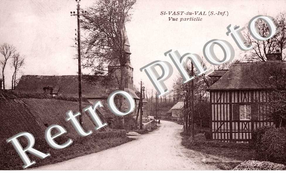 Vue Partielle