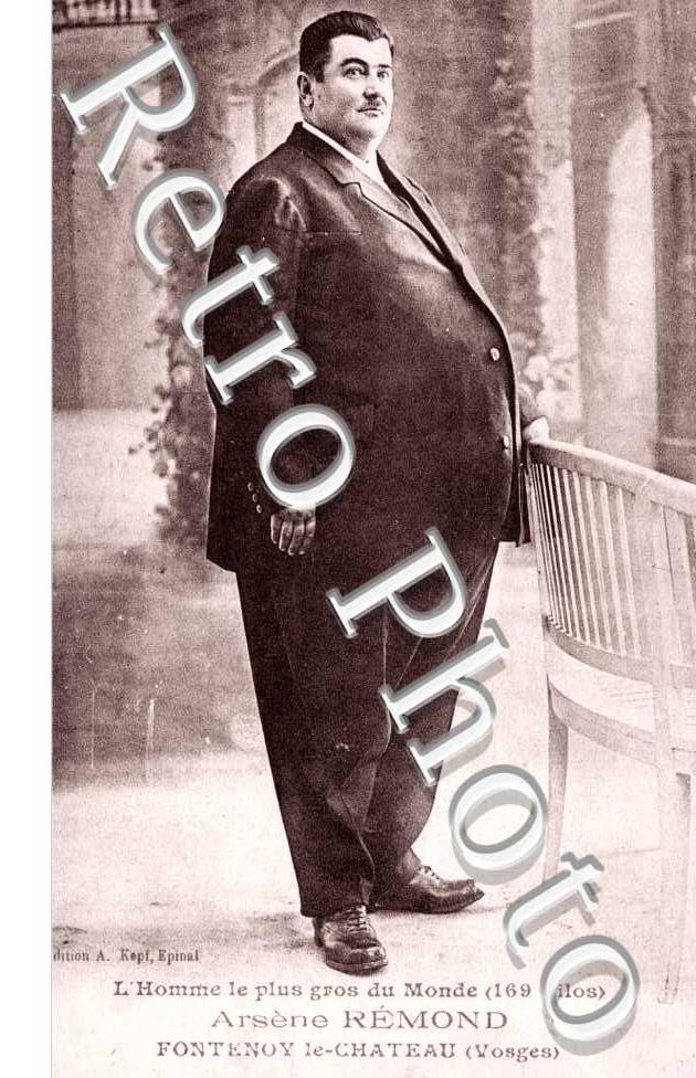 l'Homme le plus gros du Monde, 169 kilos, Arsene Remond