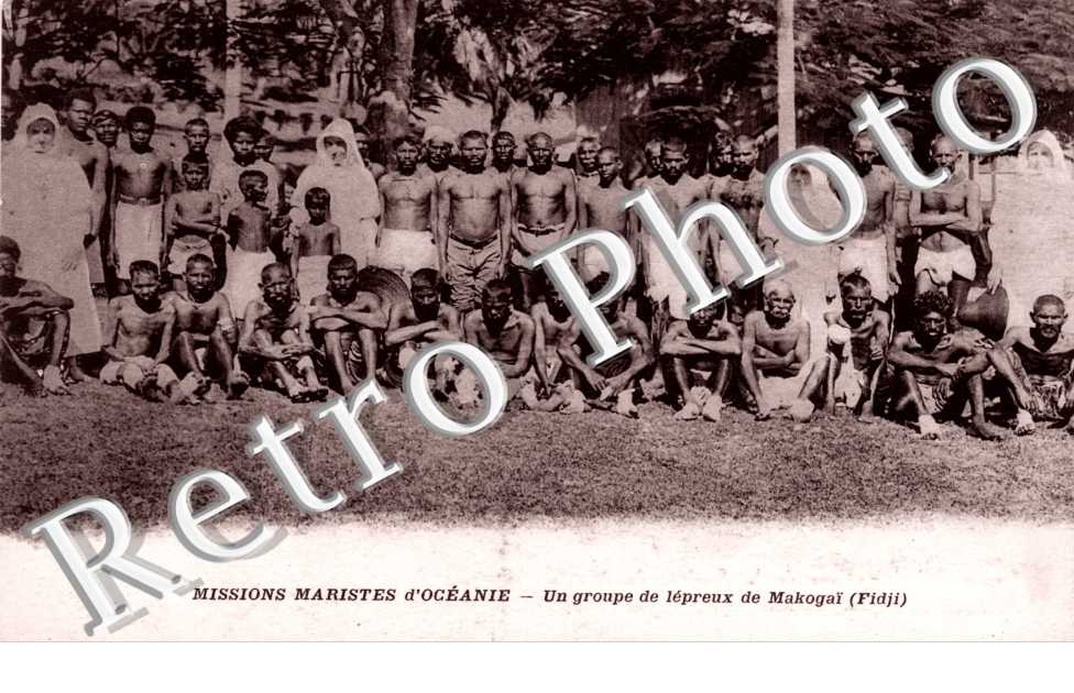 Un Groupe de lepreux MAKOGAI
