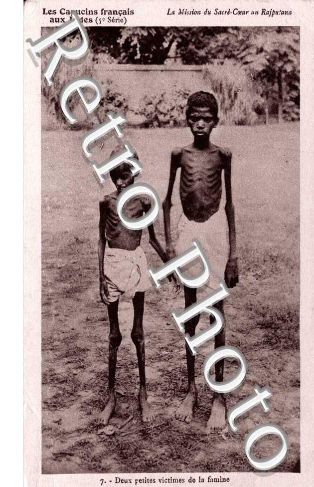 deux petites victimes de la famine