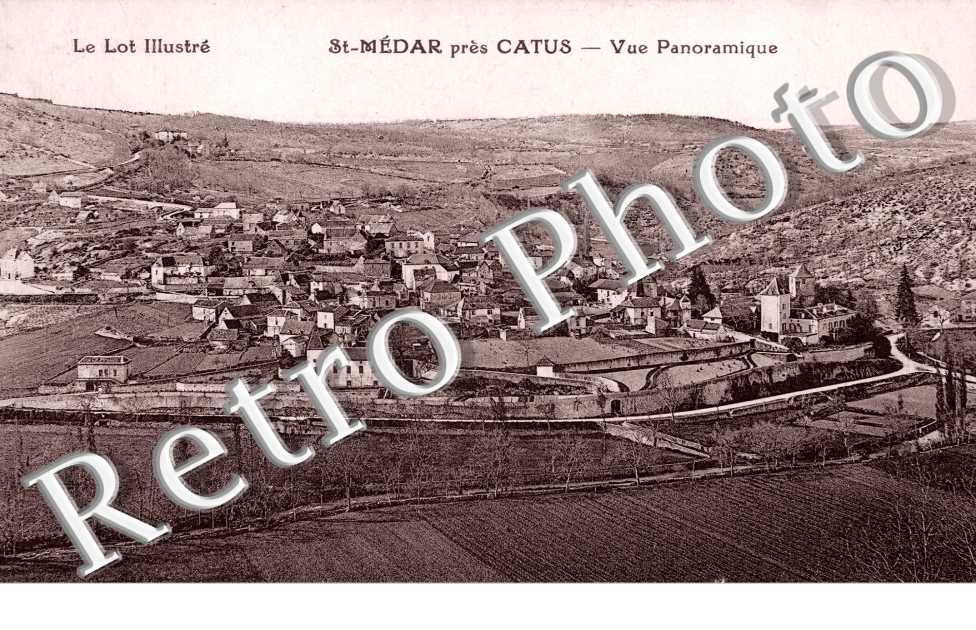 vue pa 